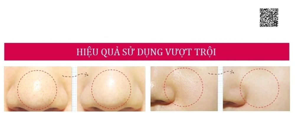 Sữa Rửa Mặt Dành Cho Da Dầu, Mụn Sakura Deep Purifying Cleansing Foam