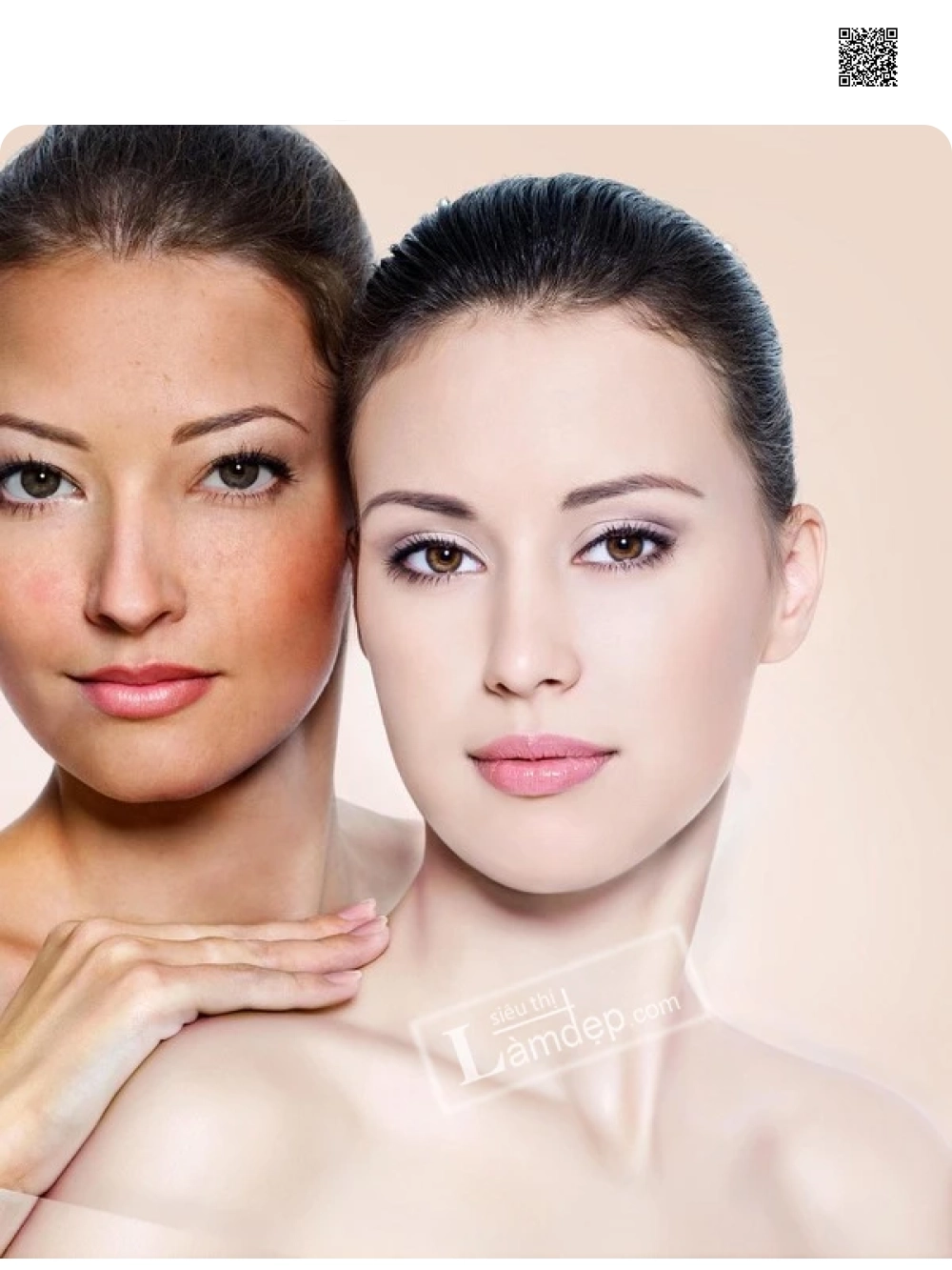 kem trắng da trị nám Giori
